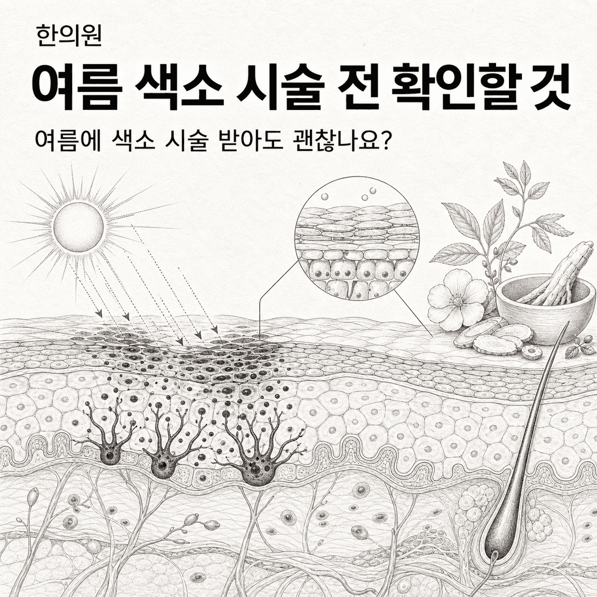 광주 한의원 여름 색소 시술 전 확인할 것 핵심 정보 이미지