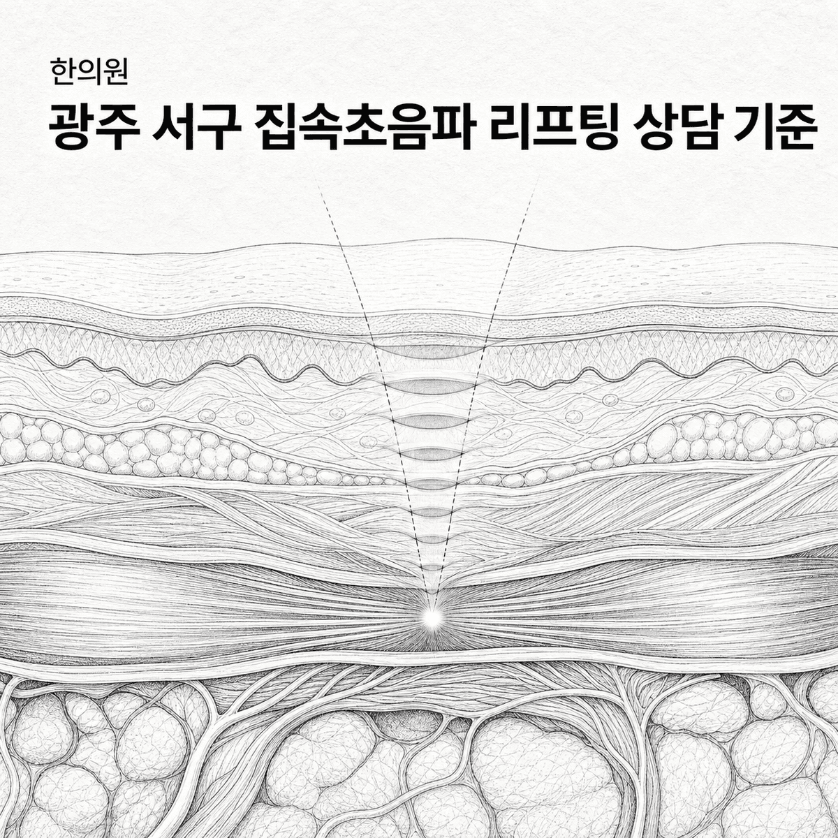 광주 한의원 서구 집속초음파 리프팅 상담 기준 핵심 정보 이미지