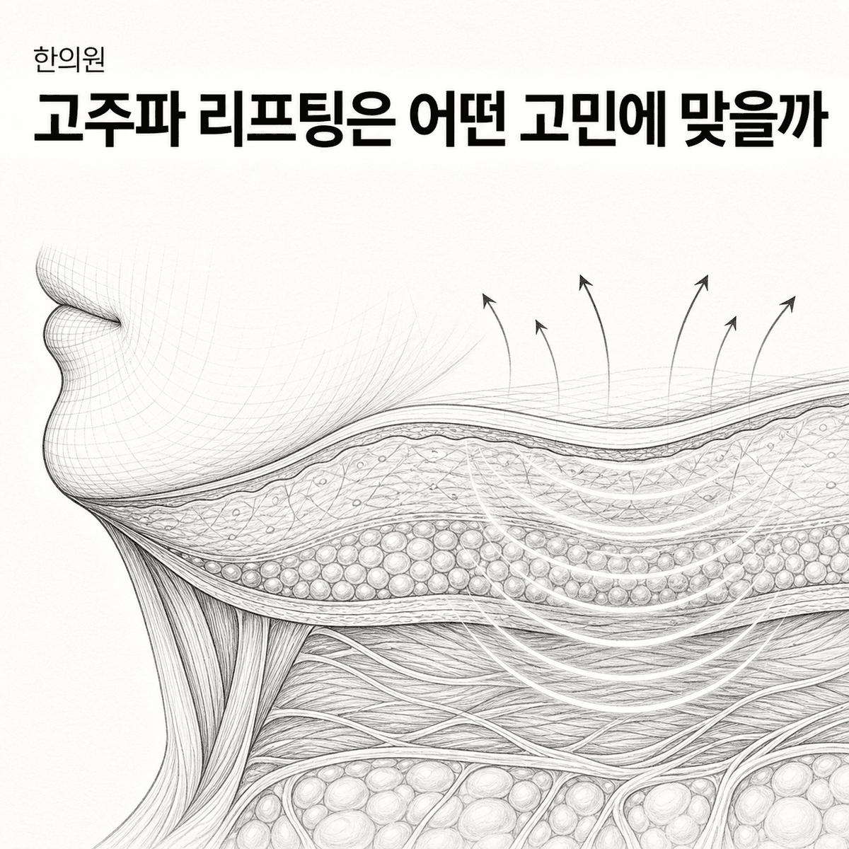 광주 한의원 고주파 리프팅은 어떤 고민에 맞을까 핵심 정보 이미지