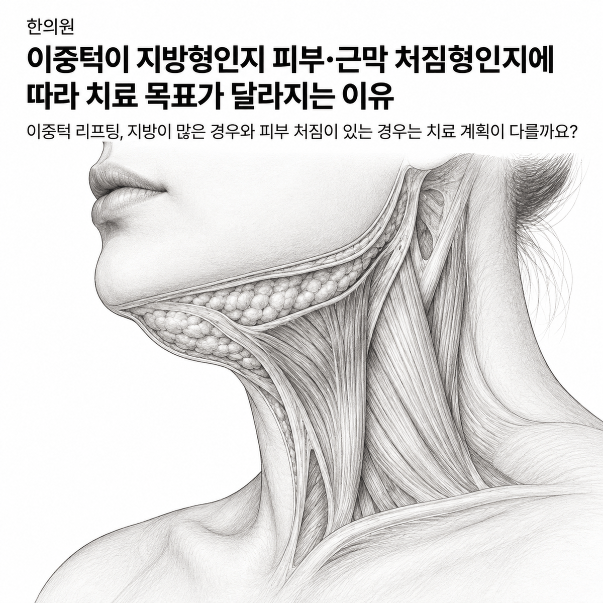 광주 한의원 이중턱이 지방형인지 피부·근막 처짐형인지에 따라 치료 목표가 달라지는 이유 핵심 정보 이미지