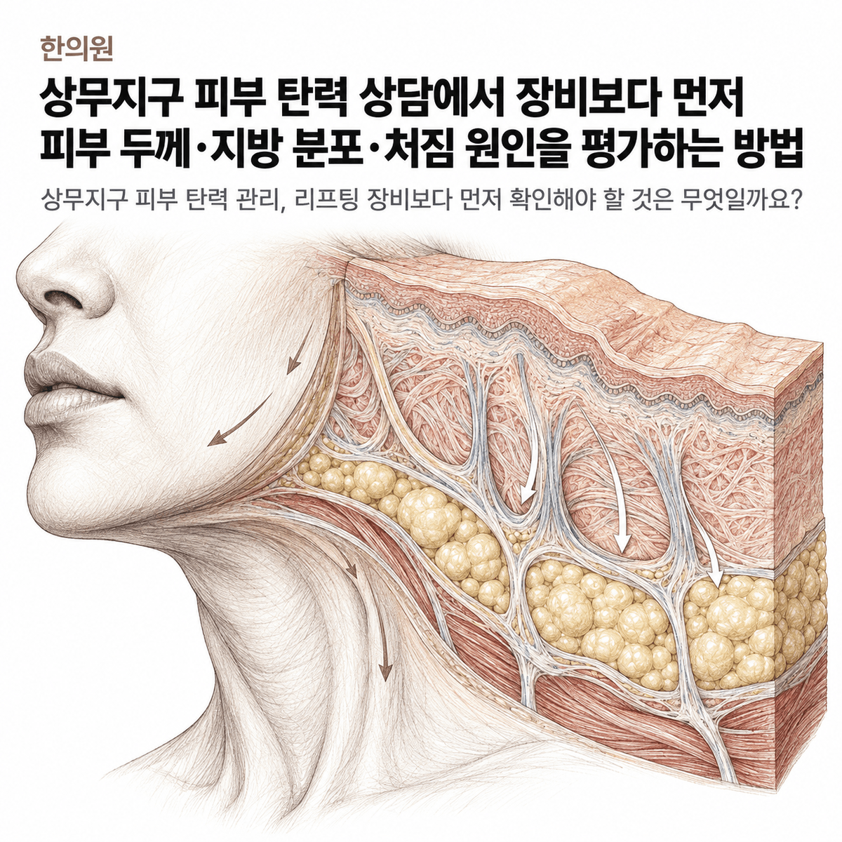 광주 한의원 상무지구 피부 탄력 상담에서 장비보다 먼저 피부 두께·지방 분포·처짐 원인을 평가하는 방법 핵심 정보 이미지
