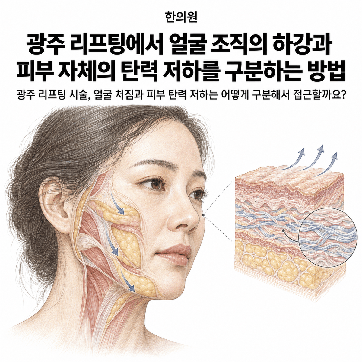 광주 한의원 리프팅에서 얼굴 조직의 하강과 피부 자체의 탄력 저하를 구분하는 방법 핵심 정보 이미지