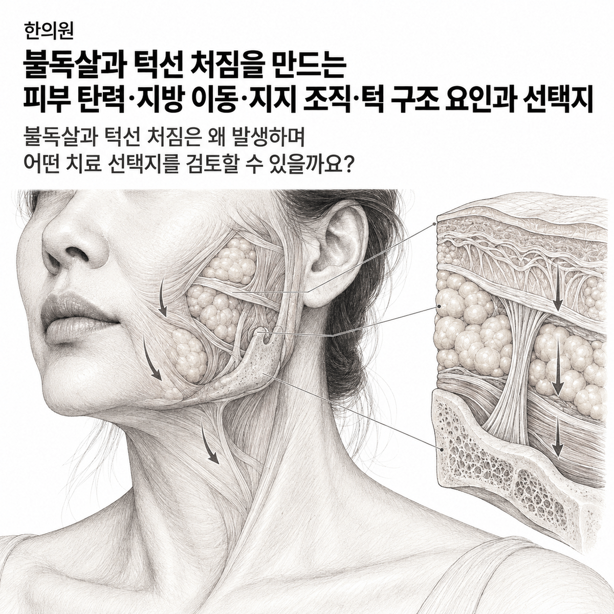 광주 한의원 불독살과 턱선 처짐을 만드는 피부 탄력·지방 이동·지지 조직·턱 구조 요인과 선택지 핵심 정보 이미지